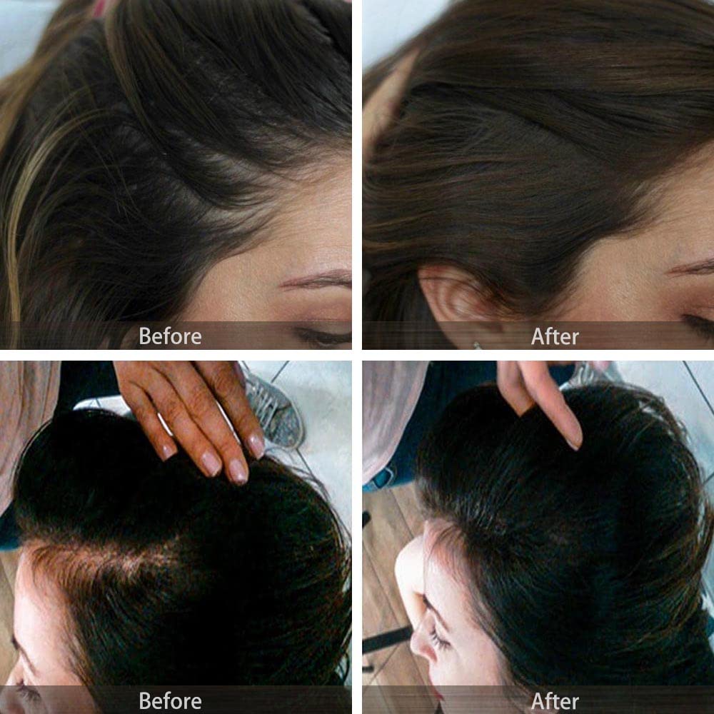 Polvo de retoque de raíz, polvo de cabello al instante para adelgazar la línea capilar para cubrir la línea capilar y oculta la pérdida de cabello,