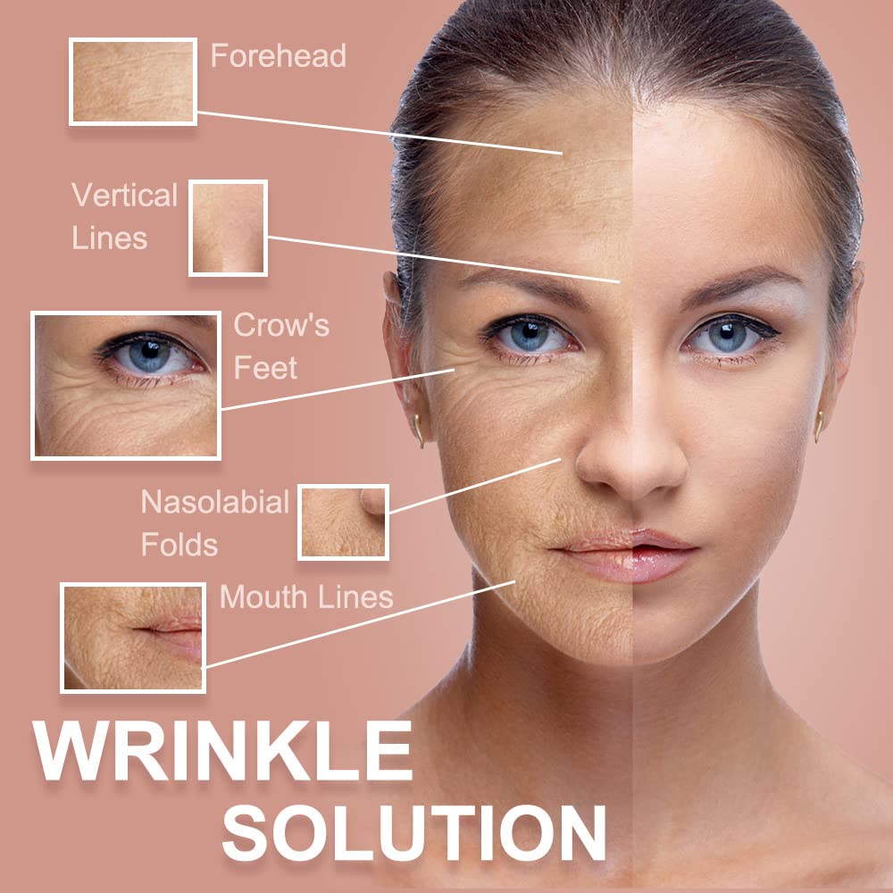 Akissos Cinta de levantamiento facial para la frente, parches de arrugas reutilizables – Cinta de estiramiento facial – Máscara de elevación de