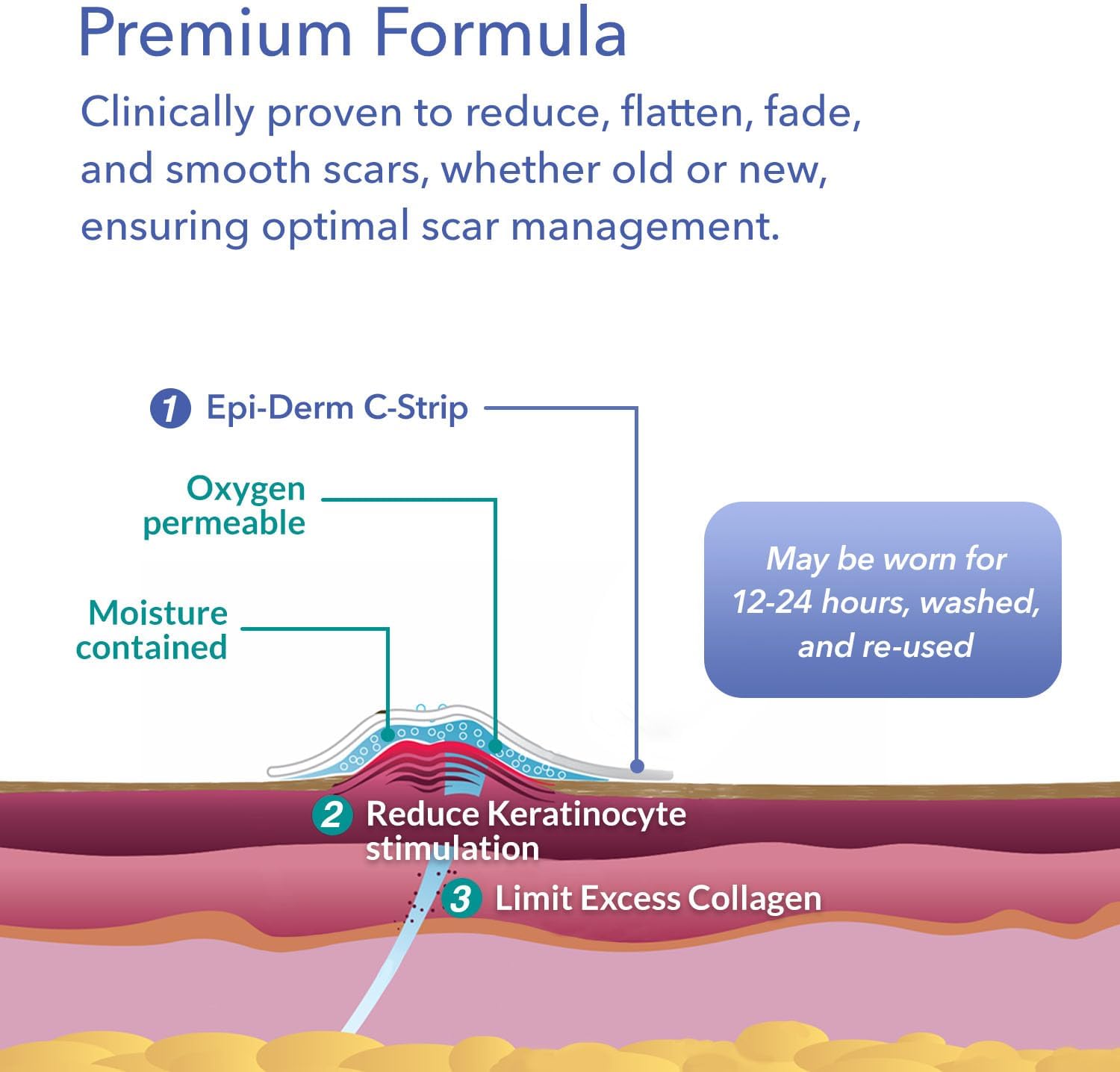 Epi-Derm C-Strips, láminas de gel de silicona para cicatrices, ideal para cesáreas, abdominoplastia, histerectomía y cicatrices de cirugía cardíaca,