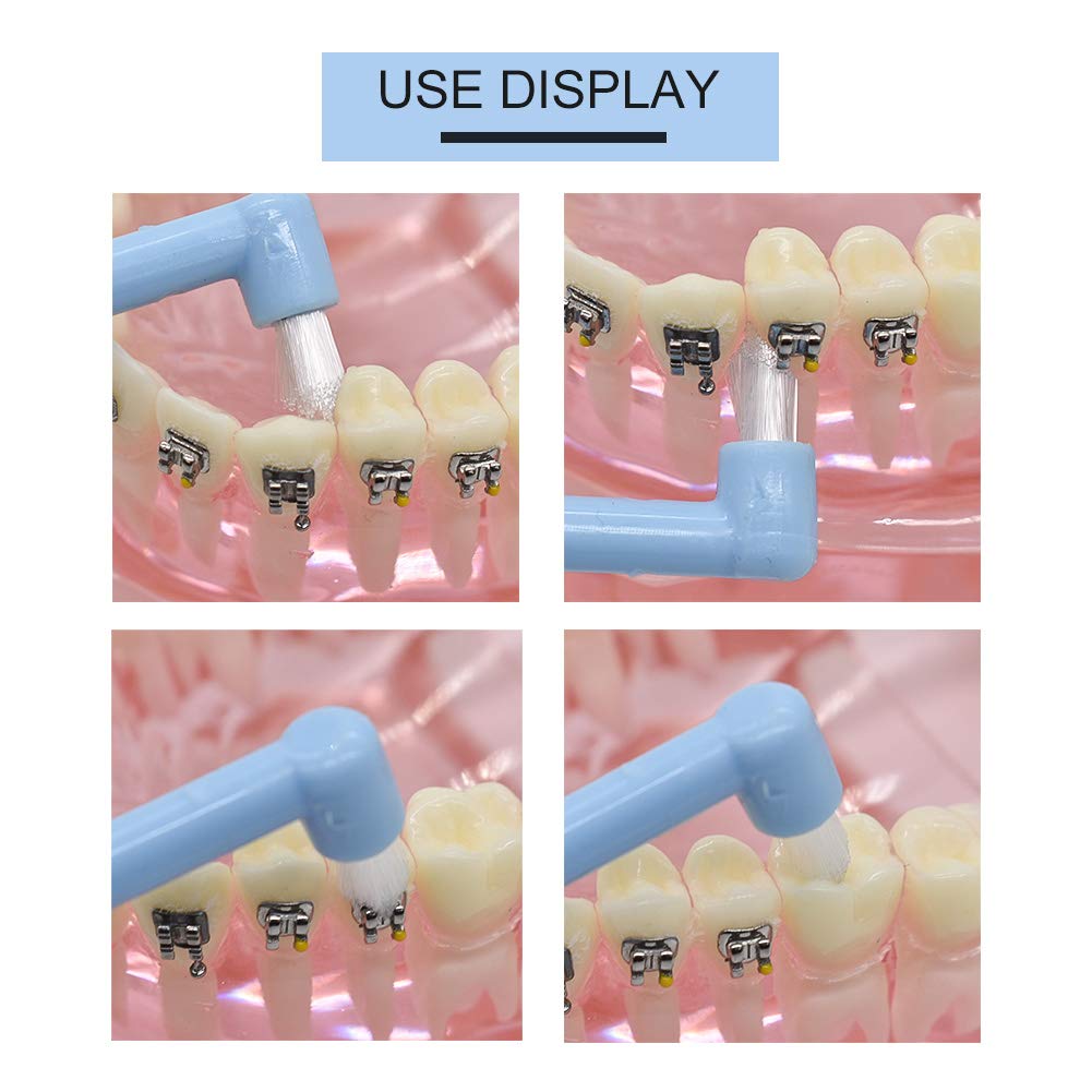 Angzhili 9 cepillos de dientes interespaciales, cepillo de dientes ortodóntico de ortodoncia para zonas difíciles de alcanzar, cepillo de dientes