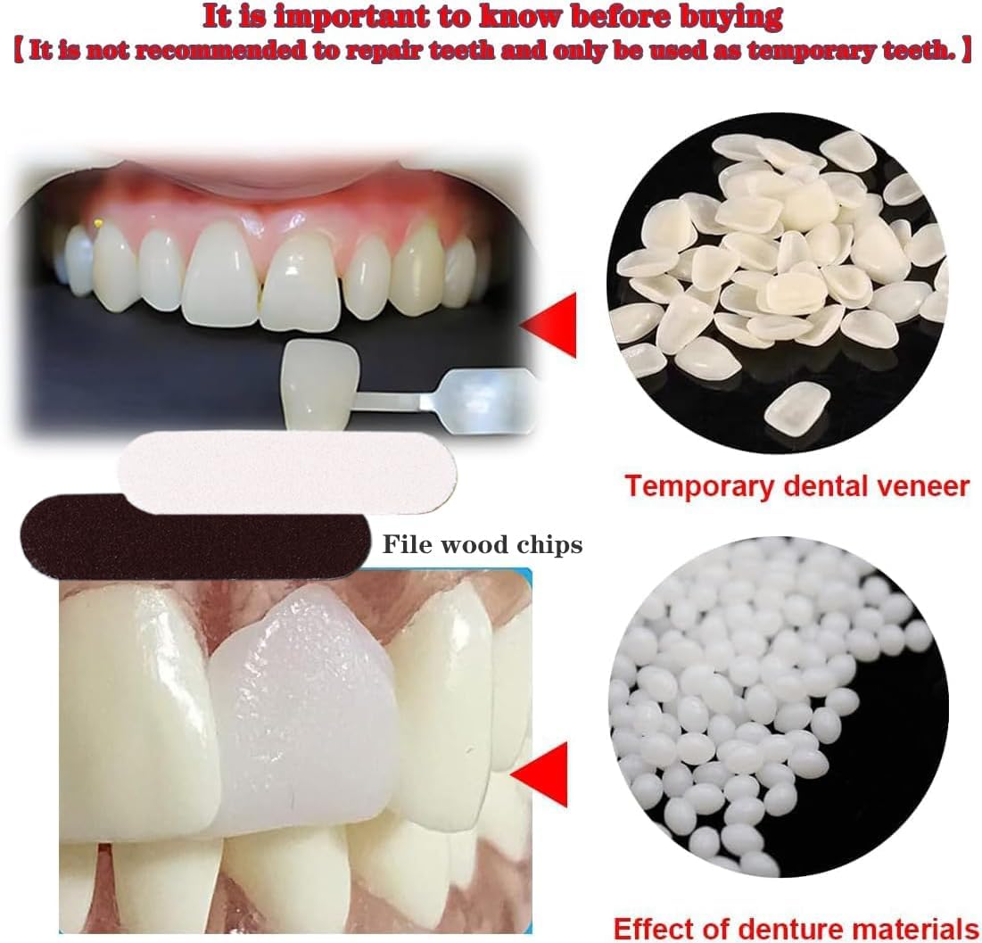 VEZE Kit de reparación de dientes, gránulos y dientes falsos para fijación temporal de dientes faltantes y rotos, dientes falsos moldeables y kit de