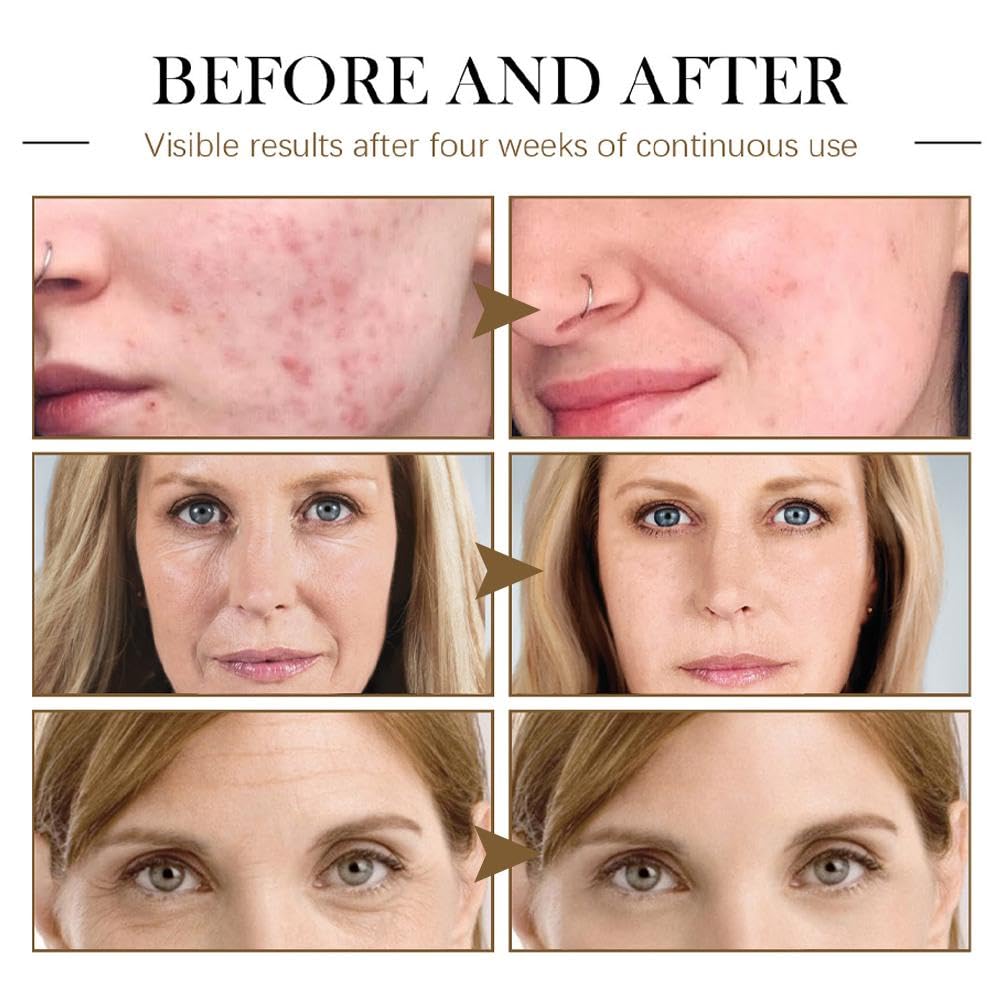 Black Seed Oil for Face, Rosehip Oil Face Serum,miracle Facial Moisturizer Organic Natural Face Oil Anti-Aging Serum Natural Skincare