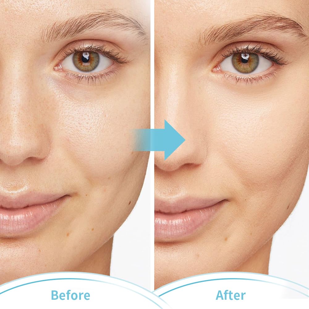 Máscaras faciales frías para ojos, máscara facial de hielo, compresa fría y caliente para ojeras, hinchazón, migrañas, dolor de cabeza, estrés,