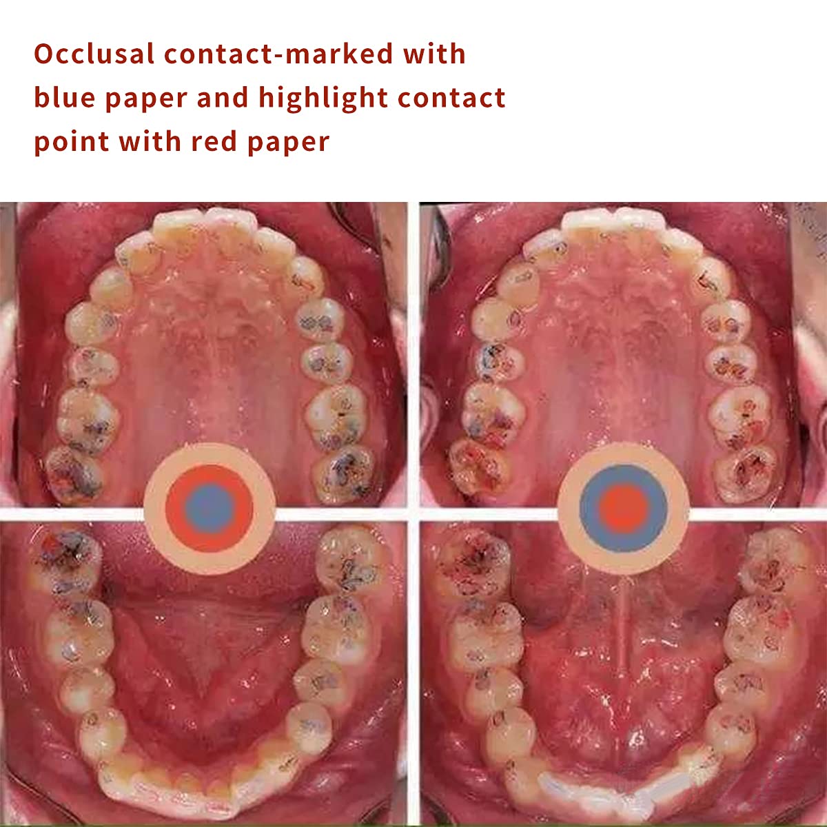 ANNWAH Papel articulado dental tiras de papel de mordida de doble cara más gruesas 100m de espesor Material para el cuidado de los dientes orales