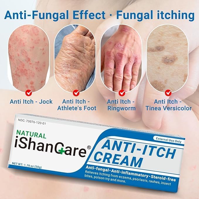 Crema calmante antipicazón extra fuerte ungüento para aliviar la picazón de la piel, para picazón de cuerpo completo causado por cambios