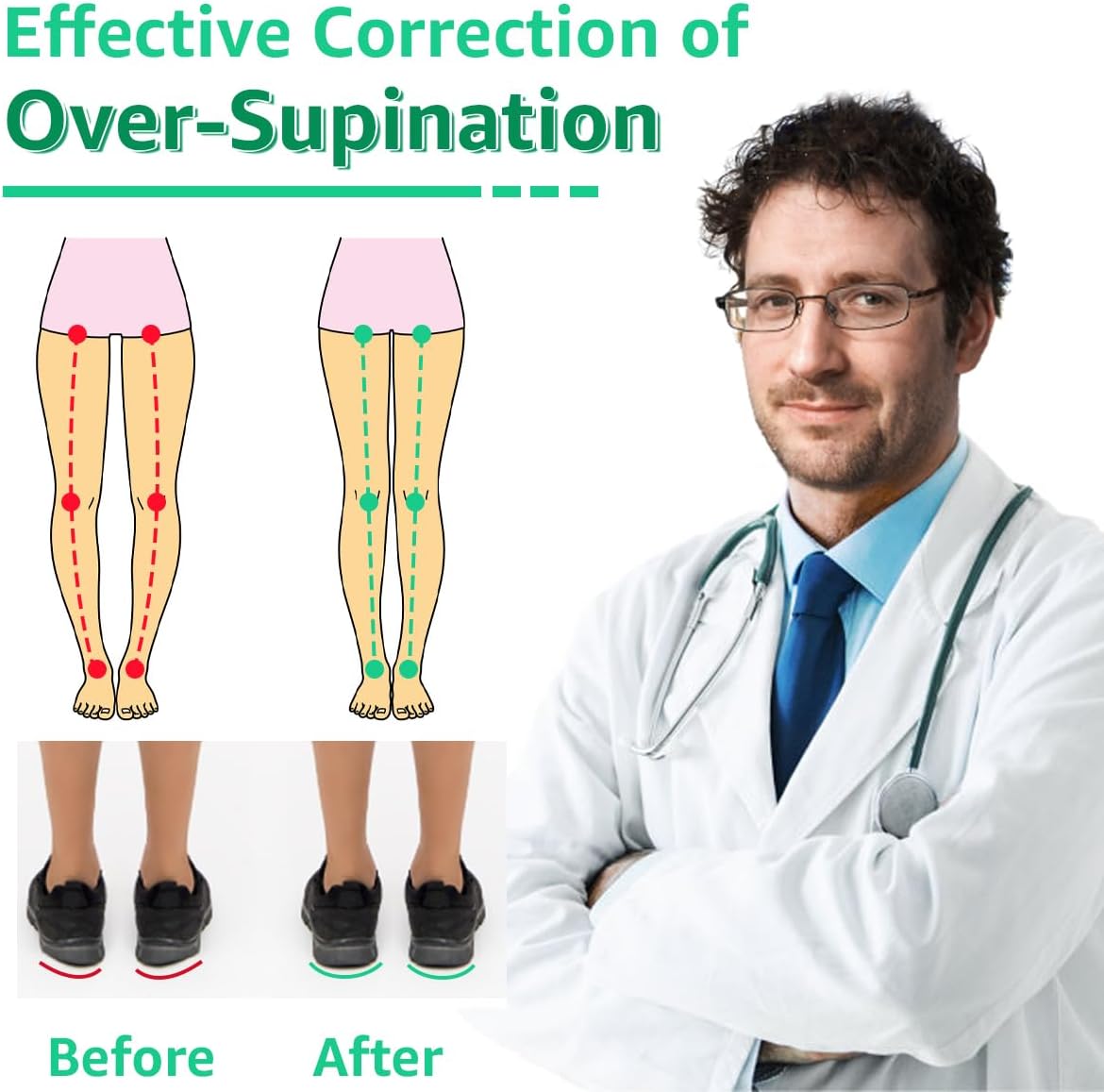 Skyfoot Insertos de cuña de talón ajustables de 3 capas para corrección de supinación y pronación, plantillas adhesivas de talón medial y lateral