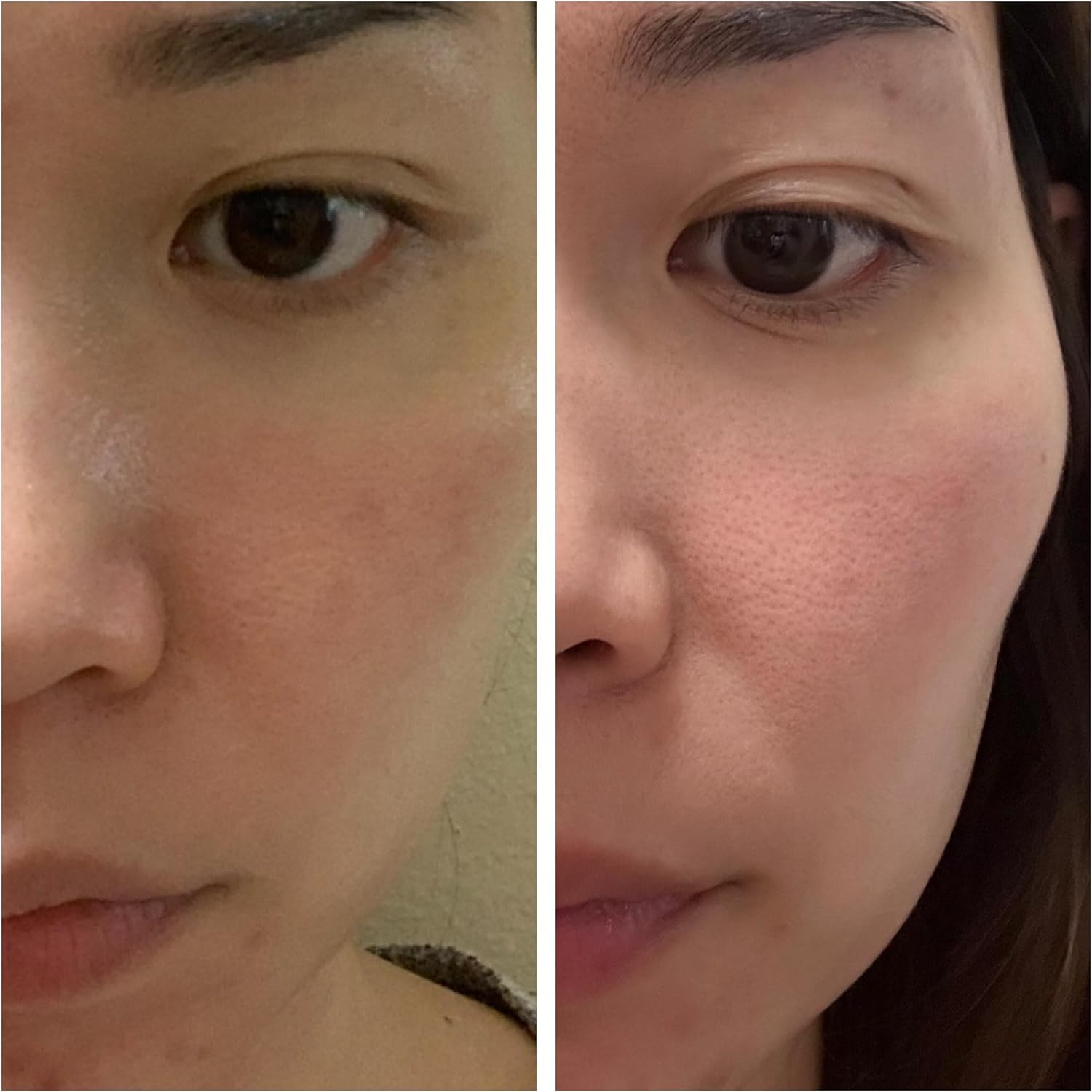 Juego coreano para el cuidado de la piel, kits simplificados de Kbeauty para el cuidado de la piel, kit facial asiático con limpiador a base de