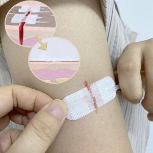 Vendajes adhesivos para cierres de heridas de emergencia, calcomanías de puntada con cremallera para camping, supervivencia y equipo doméstico, 3 Vendajes adhesivos para cierres de heridas de emergencia, calcomanías de puntada con cremallera para camping, supervivencia y equipo doméstico, 3