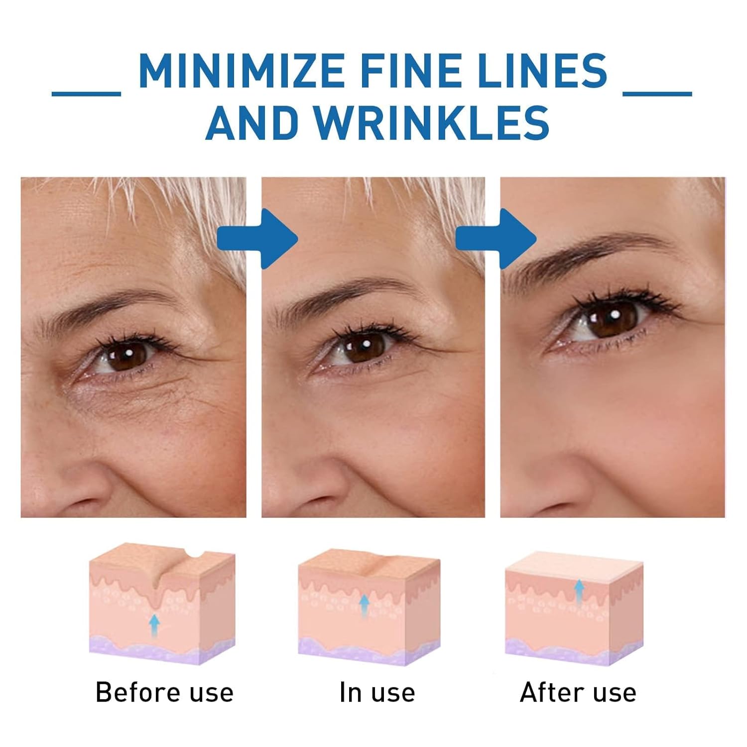 Botox – Suero facial Hyalu B5, suero facial Botox Stock Solution, suero facial Jennifer Aniston, suero antienvejecimiento, Botox en una botella,