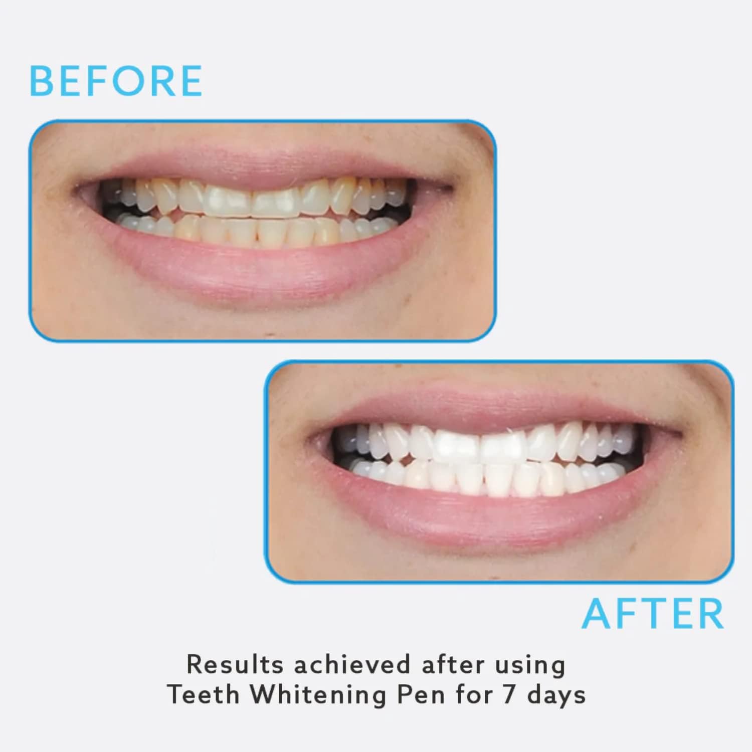 GO SMILE On The Go – Blanqueamiento dental (brillo y brillo), incluye bolígrafo blanqueador de dientes y borradores de manchas de 14 unidades
