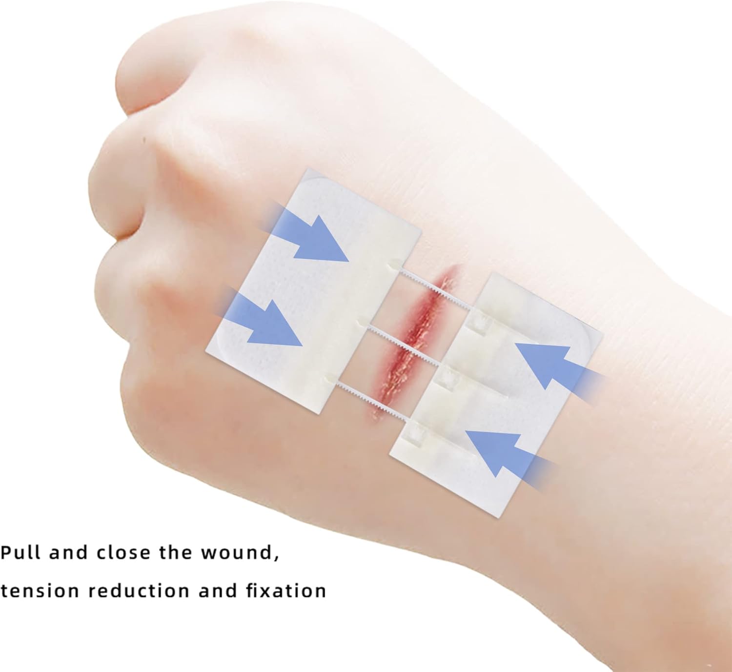Cierres de heridas de emergencia, vendajes adhesivos para cortes y heridas sin puntadas, imprescindibles para kit de primeros auxilios, kit de