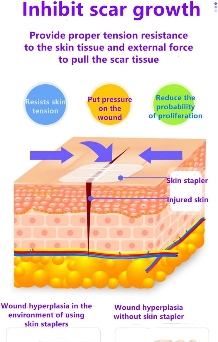 Cierres de heridas de emergencia, vendajes adhesivos para cortes y heridas sin puntadas, imprescindibles para kit de primeros auxilios, kit de