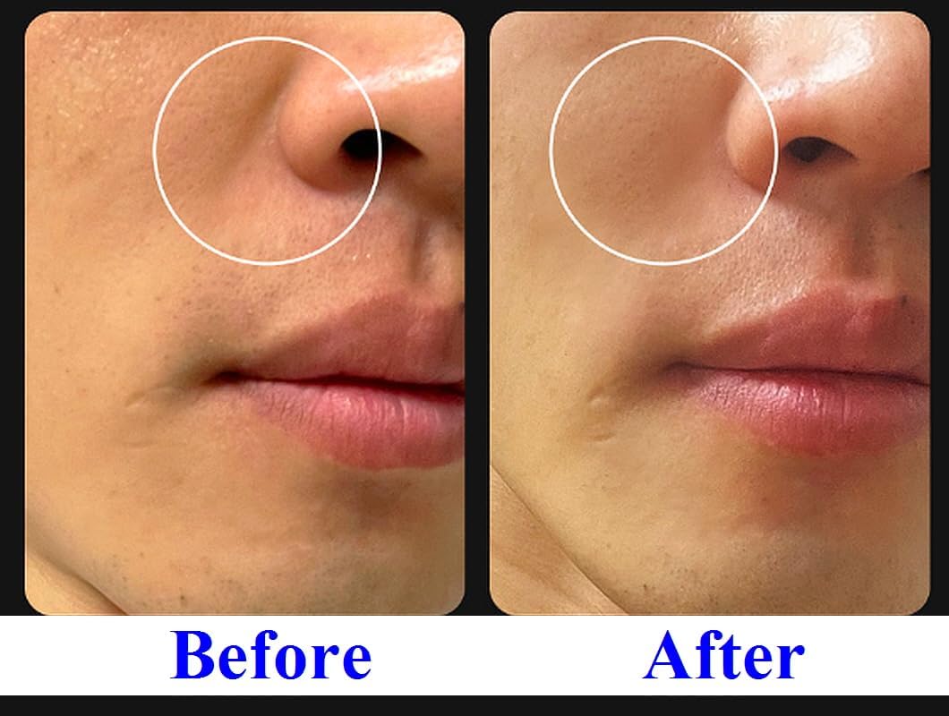WHITESILK T1(SS) COLLAGEN 100 INSTANT Reverse Lift Facial Toning Peel Off Mascarilla facial para una piel más firme, húmeda y brillante con colágeno