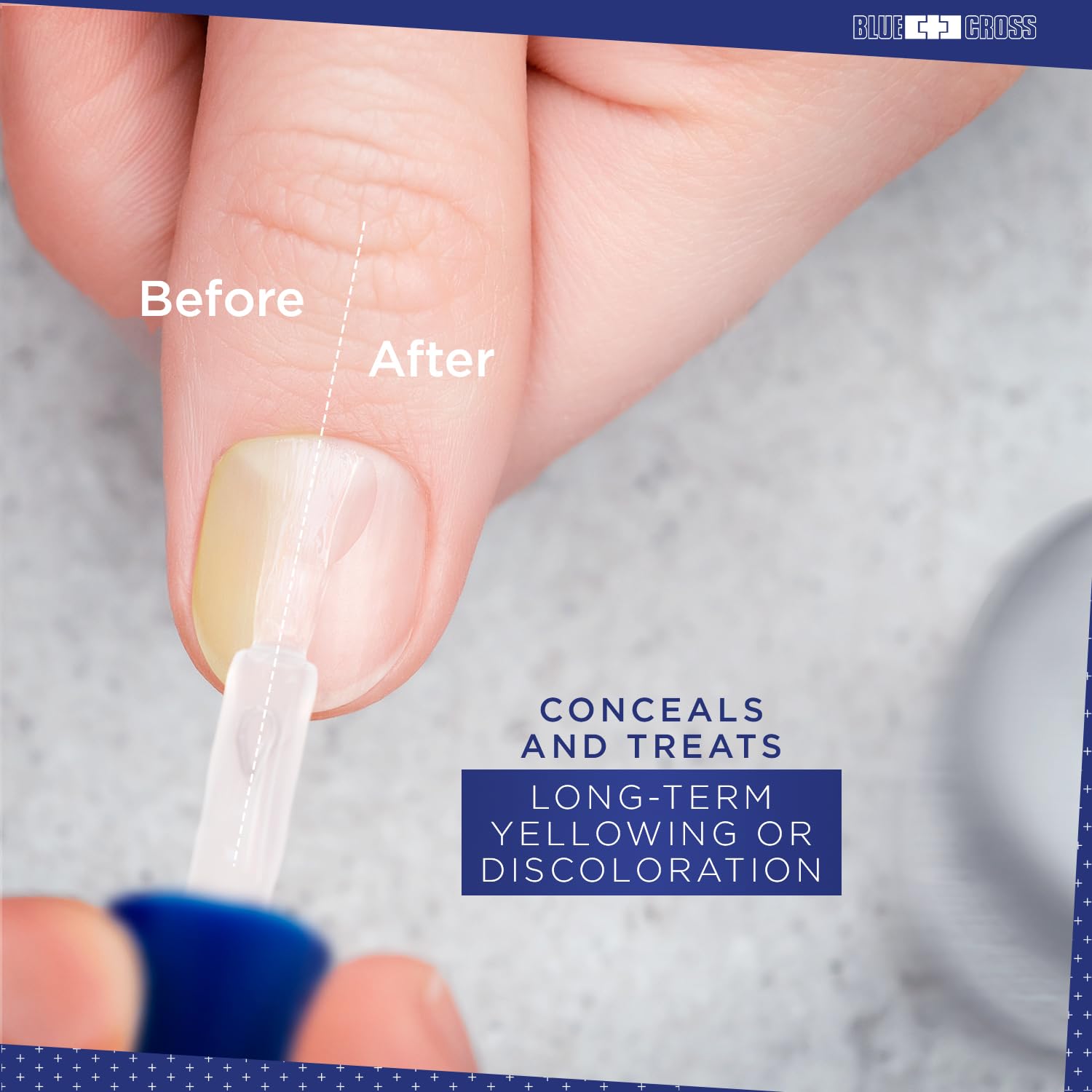 Blue Cross Cuidado profesional de uñas Yello Out – Tóner morado neutralizante de amarillo + capas base ópticas para aclarar uñas, paquete de 2