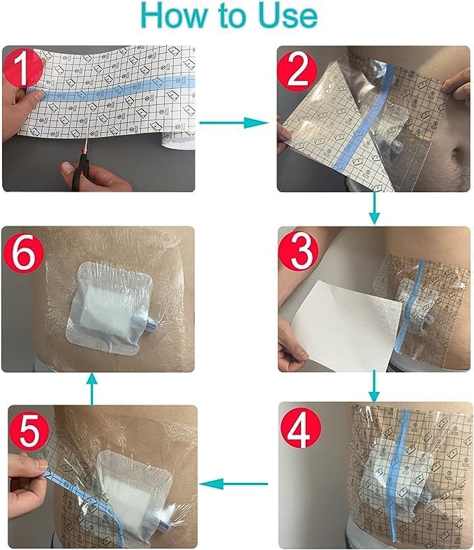 Vendajes de incisión impermeables posquirúrgicos para vendaje de heridas grandes, parche adhesivo transparente para diálisis PICC, puerto de pecho,