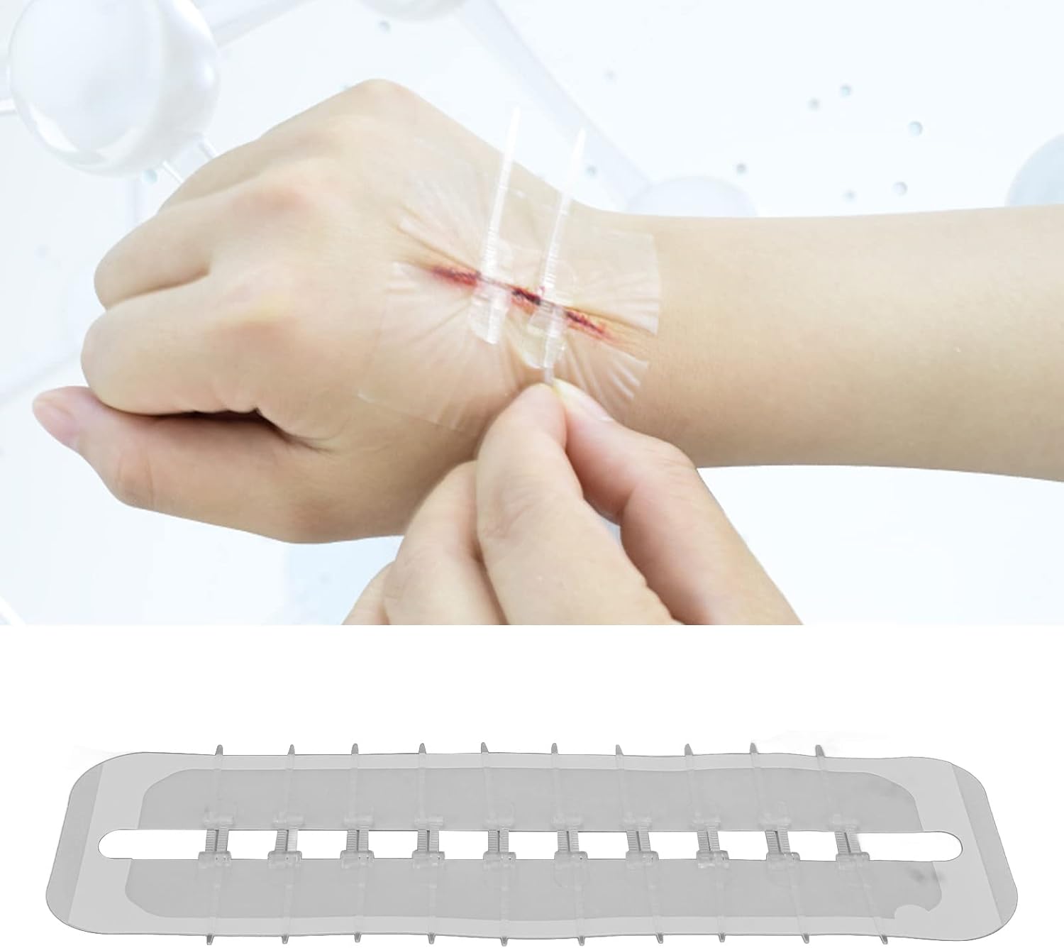 Dispositivo de cierre de heridas con puntada de cremallera, kit de laceración de 2 piezas, vendas Steri Strip Bandaids reparación de laceración