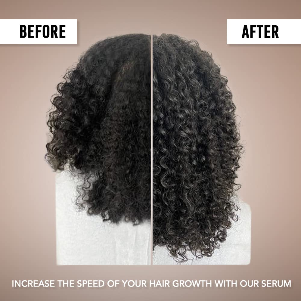 Amyla Cosmetics Suero para el crecimiento del cabello, tratamiento capilar para mujeres 1 onza líquida (1.0 fl oz)