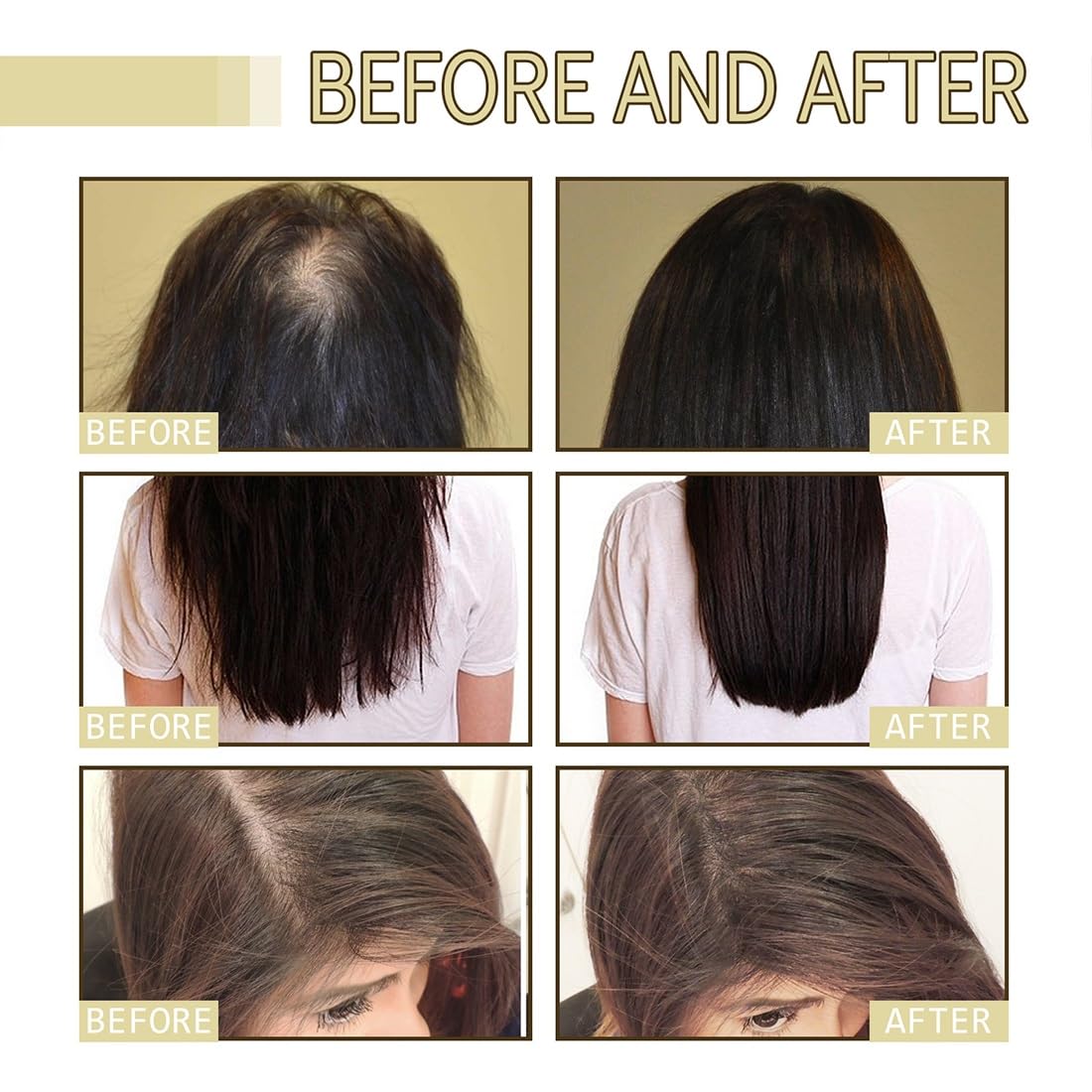 Tiworld – Aceite natural para el crecimiento del cabello, aceite natural vegano para el crecimiento del cabello, aceite de romero orgánico para el