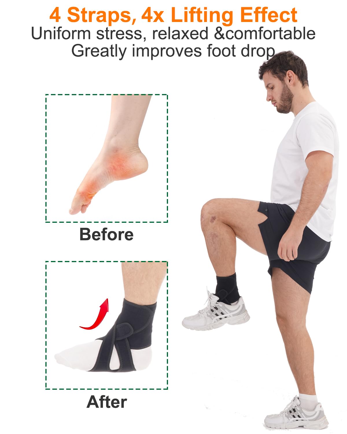 Furlove AFO – Soporte de pie para caminar, soporte de pie caído con zapatos, férula nocturna suave para caída del pie, soporte de caída de pie para