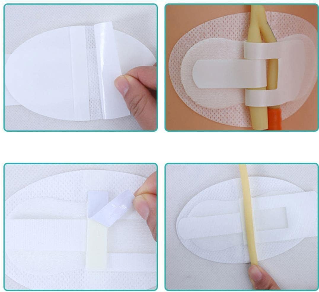 Dispositivo de estabilización de catéter, soporte para bolsa de catéter, soporte de banda para piernas de catéter, adhesivo de fijación de tubo