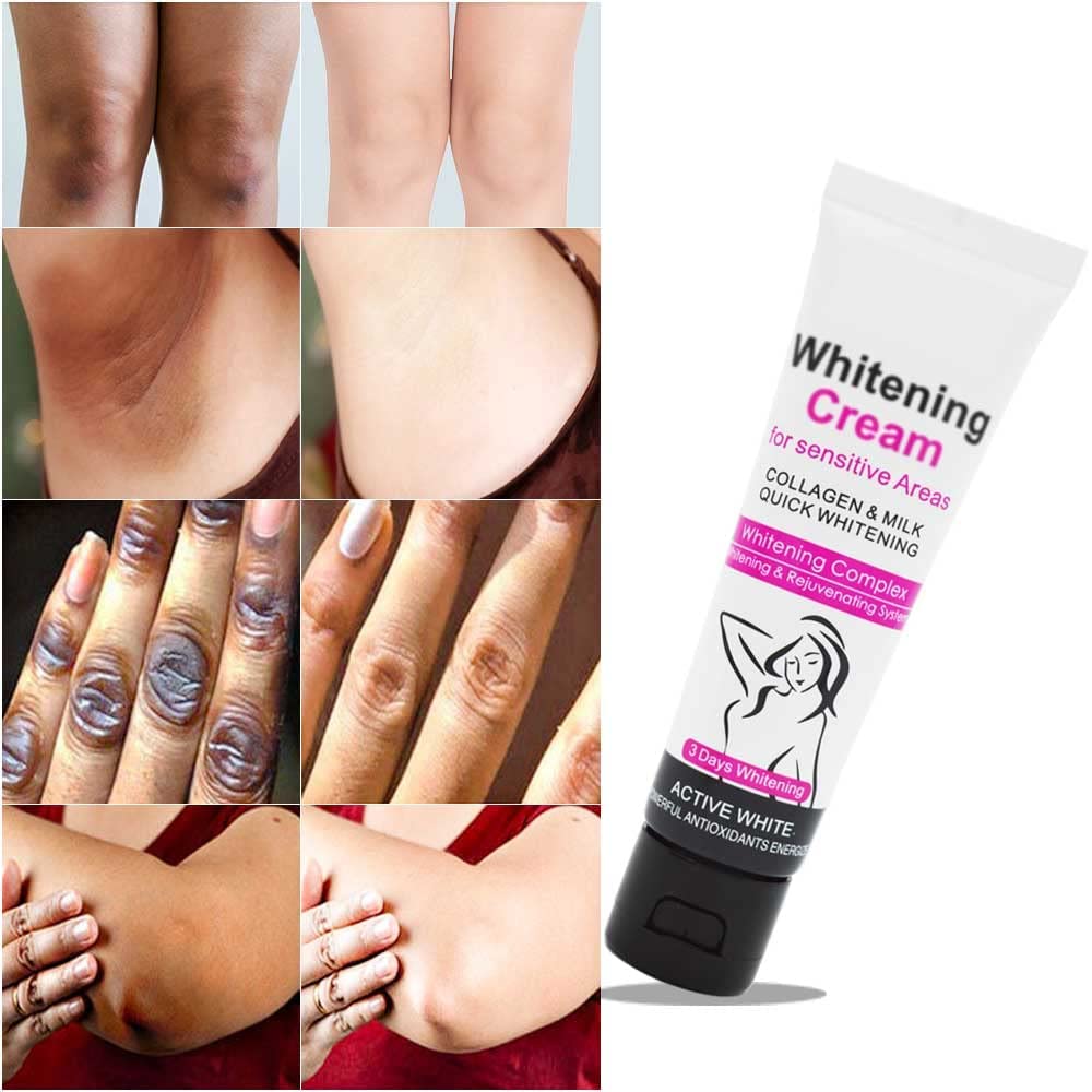 Acclyd – Crema corrector de manchas oscuras para el cuerpo, áreas íntimas, axilas, axilas, rodillas, piernas, codos y muslos internos, crema