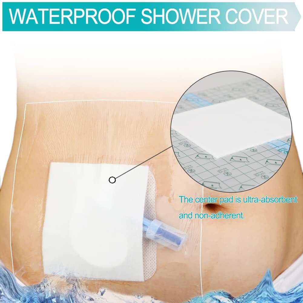 Vendajes de incisión impermeables posquirúrgicos para vendaje de heridas grandes, parche adhesivo transparente para diálisis PICC, puerto de pecho,