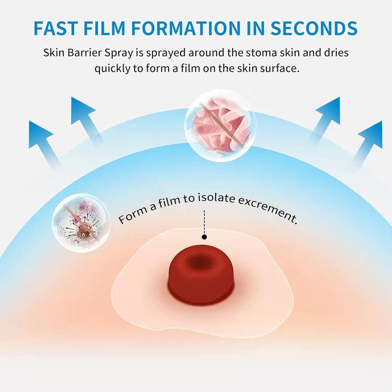 ovand Spray de barrera para la piel de ostomía de 1.0 fl oz, sin alcohol y sin picazón para el cuidado de la ostomía, aerosol de barrera de la piel,