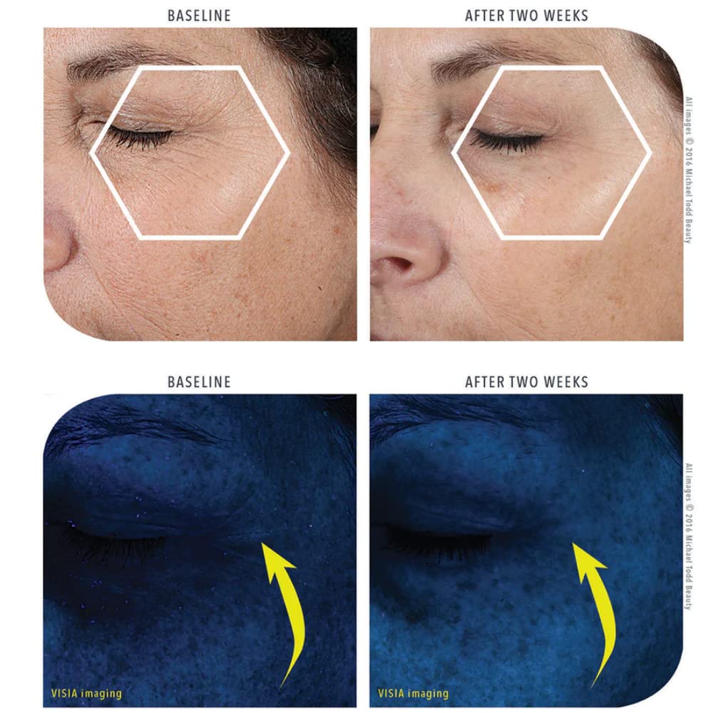 MICHAEL TODD Crema Beauty KNU  Crema para levantar la cara, aclarar y tensar  Para Hidratar y Rejuvenecer  Con Bakuchiol, Péptidos y Secreción de