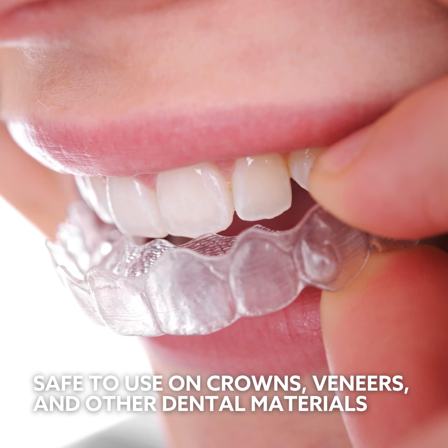 GO SMILE On The Go – Blanqueamiento dental (brillo y brillo), incluye bolígrafo blanqueador de dientes y borradores de manchas de 14 unidades