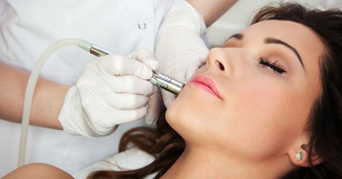 NeedCrystals Cristales de microdermoabrasión para máquinas, paquete de 2, tratamiento exfoliante facial totalmente natural para piel opaca o seca,
