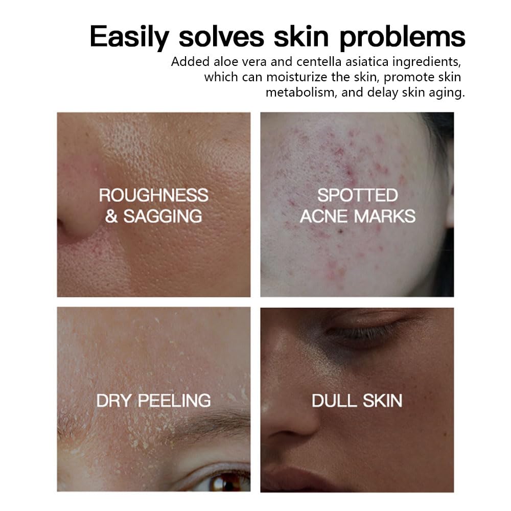 Suero facial de niacinamida para cara y piel, suero facial hidratante para acné, manchas oscuras, poros, líneas finas