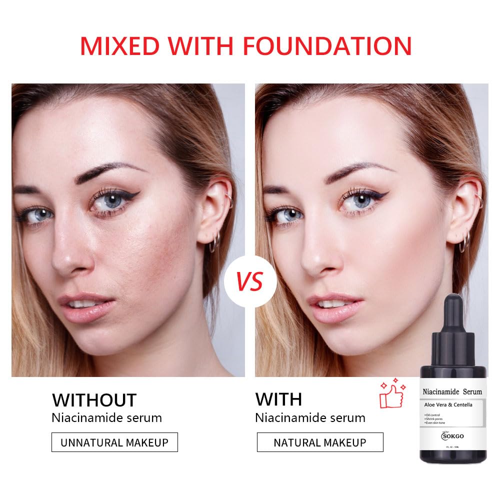 Suero facial de niacinamida para cara y piel, suero facial hidratante para acné, manchas oscuras, poros, líneas finas