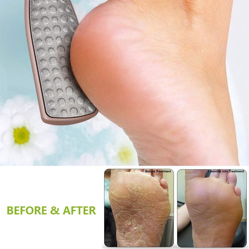 BEZOX Lima de pie, raspador de pies de doble cara, removedor de callos de pedicura de acero inoxidable con bolsa de almacenamiento de tela y caja de