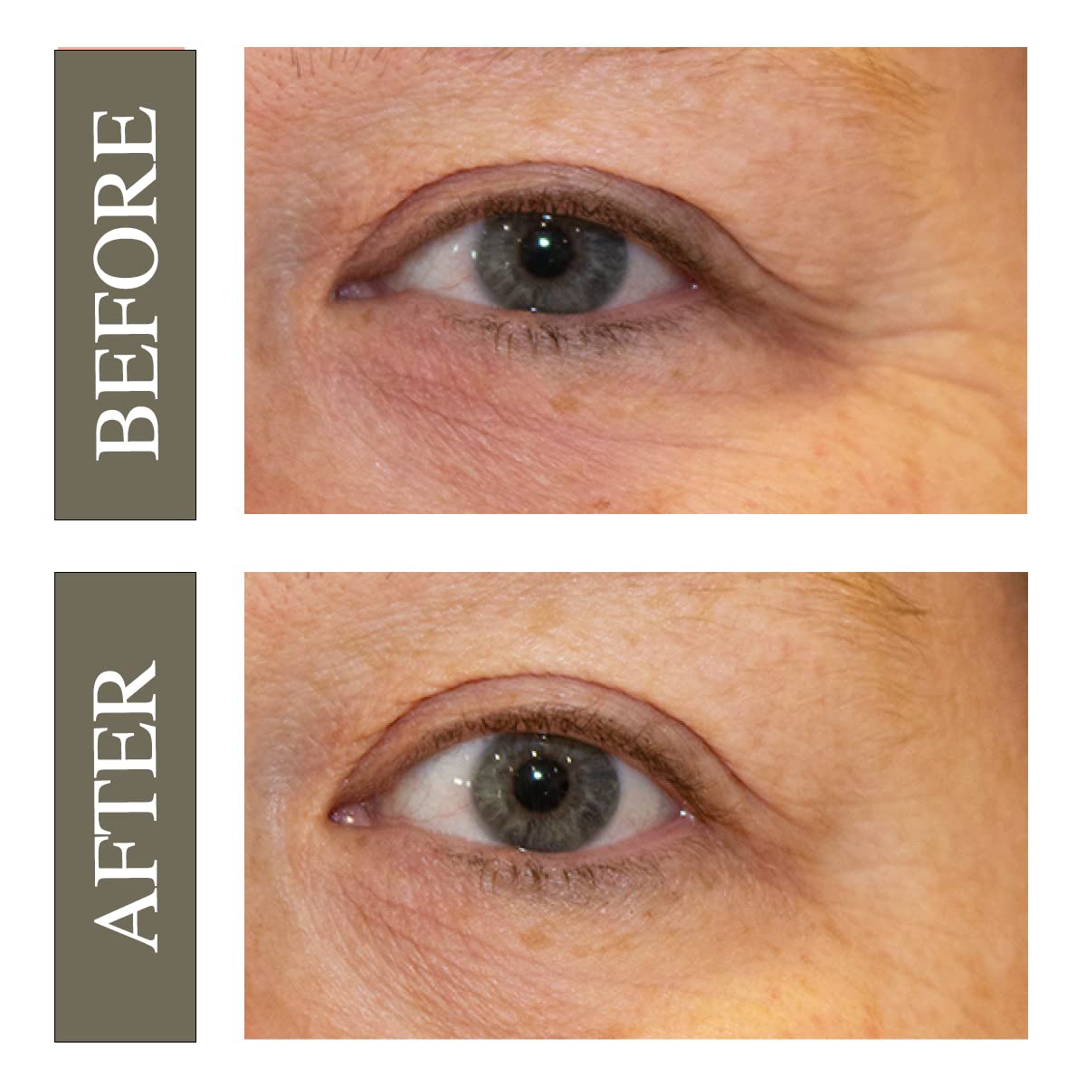 Hey Honey Open Your Eyes Lifting Eye Serum  Crema debajo de los ojos para ojeras e hinchazón  Hidratación alrededor de los ojos  Adecuado para