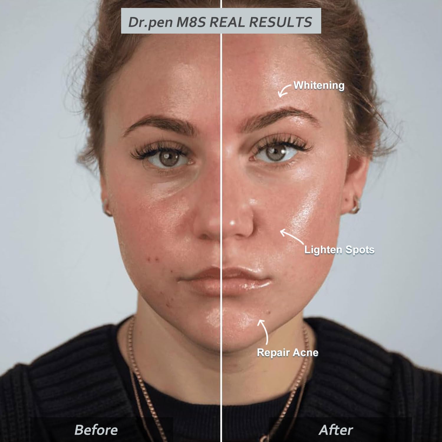 Dr. Pen M8S Microneedling Pen con 20 cartuchos de repuesto, kit de bolígrafo inalámbrico Derma Microneedle, herramientas profesionales para el