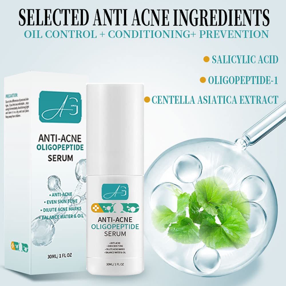 Suero de oligopéptido anti-acné para reparación de barrera de piel de cuidado facial. Tratamiento para aclarar marcas y hoyos, estimulando la