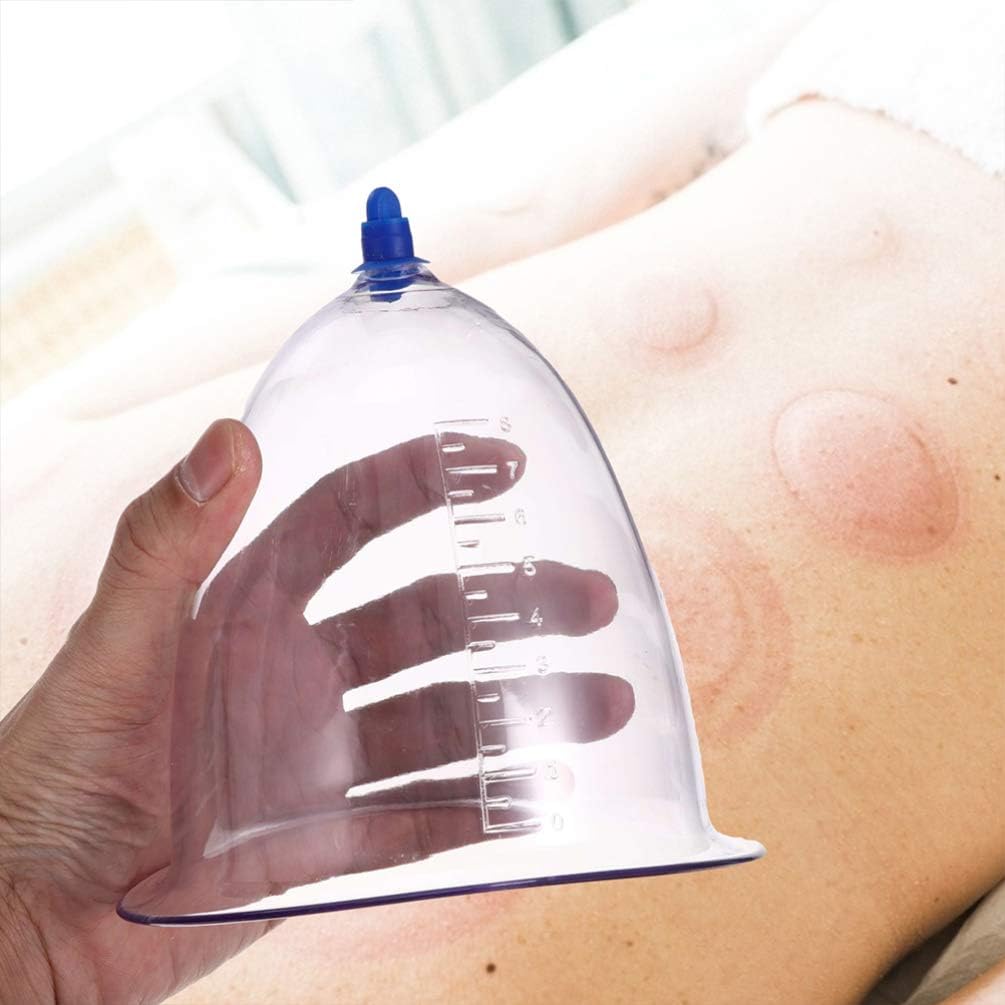 Dispositivo de terapia de ventosas al vacío de presión negativa, conjunto de ventosas al vacío, conjunto de ventosas para el cuerpo, cuerpo de