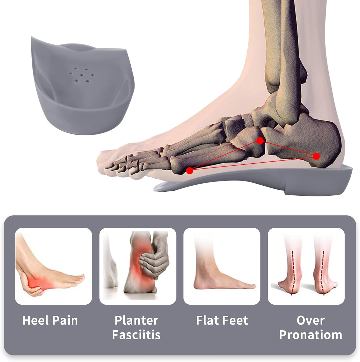 Almohadilla metatarsiana original de arco alto 34 para aliviar la pronación del pie, espalda, cadera, pierna y rodilla, espolones para el dolor para