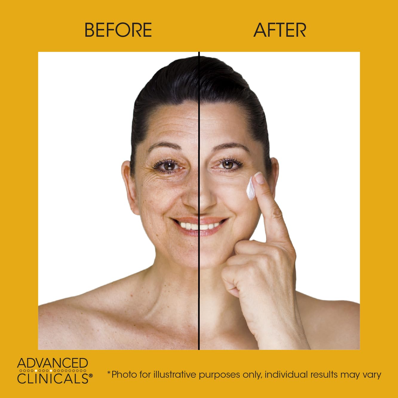 Advanced Clinicals Set de 2 lociones corporales de retinol + crema de aceite de coco, loción facial hidratante y crema corporal  Tratamiento para el