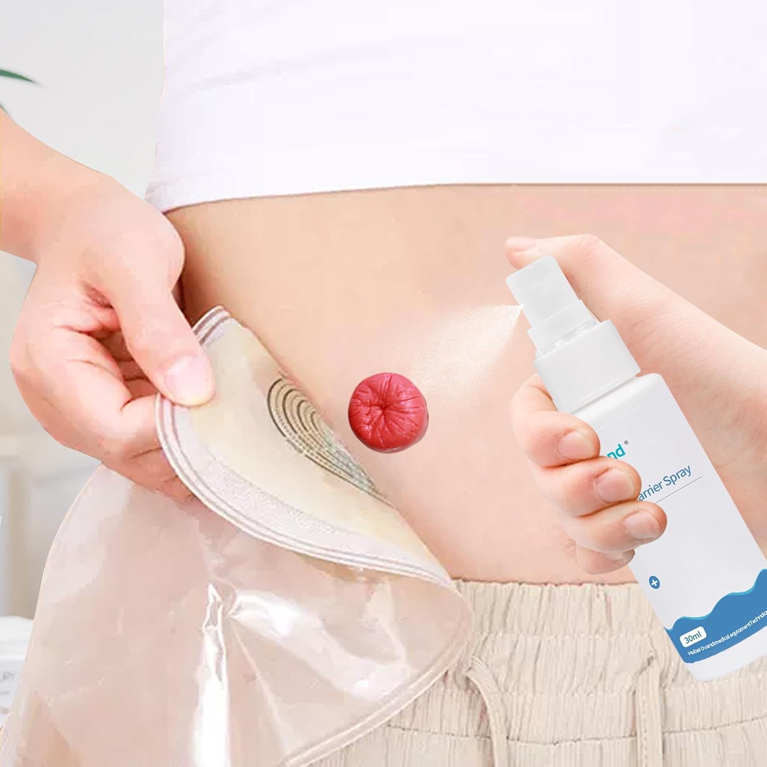 ovand Spray de barrera para la piel de ostomía de 1.0 fl oz, sin alcohol y sin picazón para el cuidado de la ostomía, aerosol de barrera de la piel,