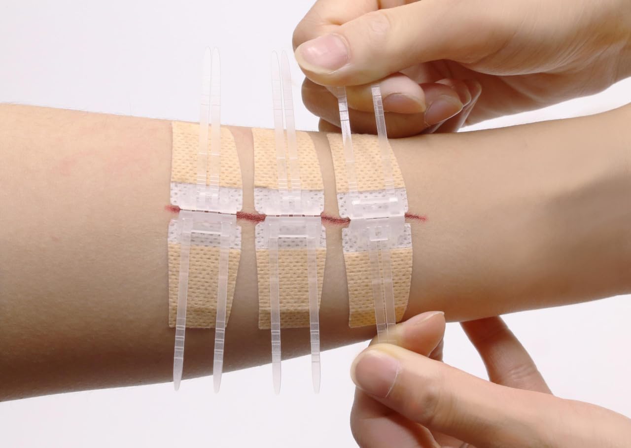 Dispositivo de cierre de heridas por laceración, tiras de cierre de laceración de emergencia para reparar – Paquete de 10 unidades