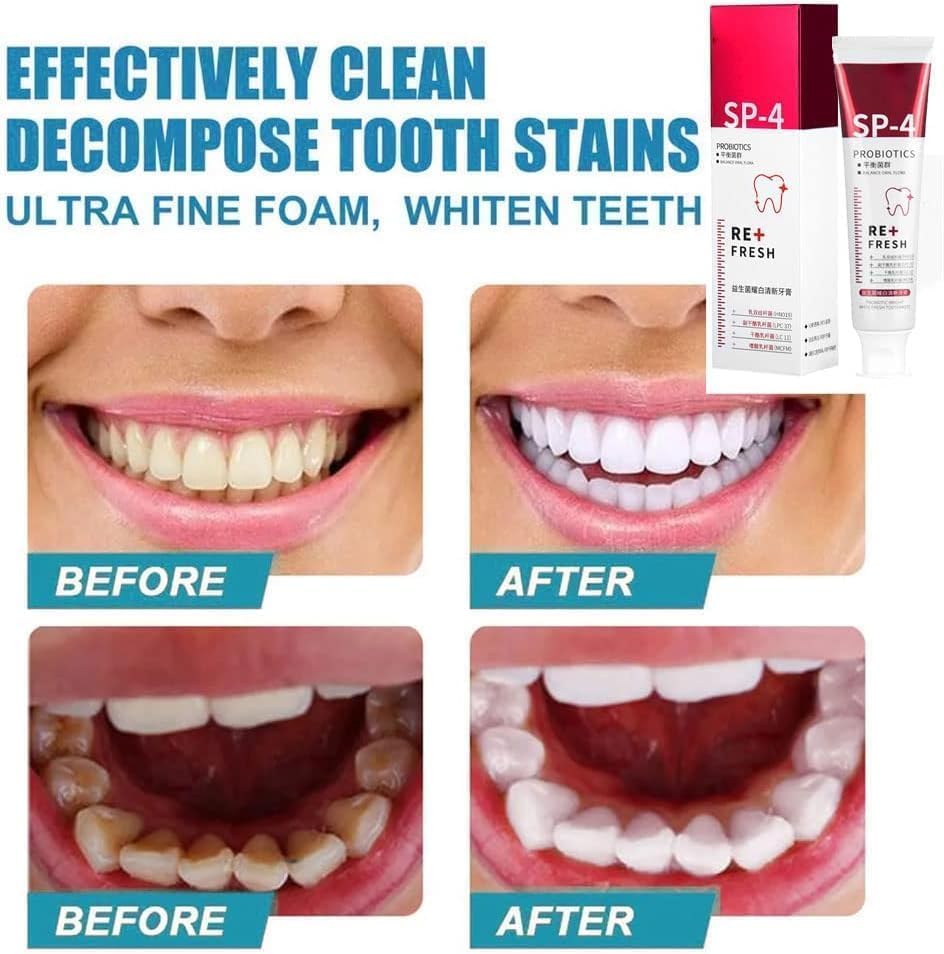 Pasta de dientes blanqueadora SP-4 Probióticos, pasta de dientes Yayashi SP-4, pasta de dientes de aliento fresco, promueve dientes y encías