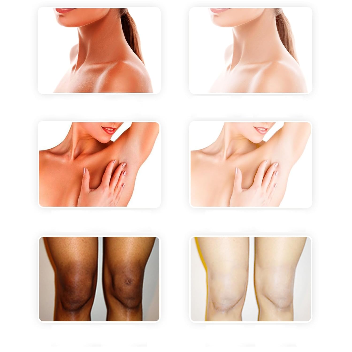 Crema Blanqueadora para Partes Intimas, Crema para Las Manchas de La Cara, Crema para Aclarar las Axilas Y Partes Intimas, Leche Con Colageno Crema