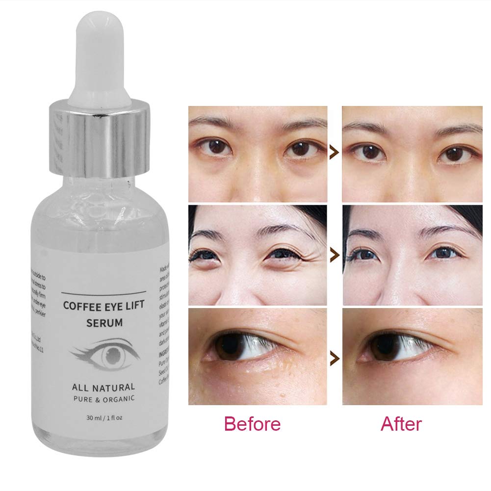 Cafeína Cuidado de los Ojos Suero Círculo Oscuro Eliminación Ojo Bolsa Reafirmante Suave 1.0 fl oz Repone Nutrientes Textura Ligera
