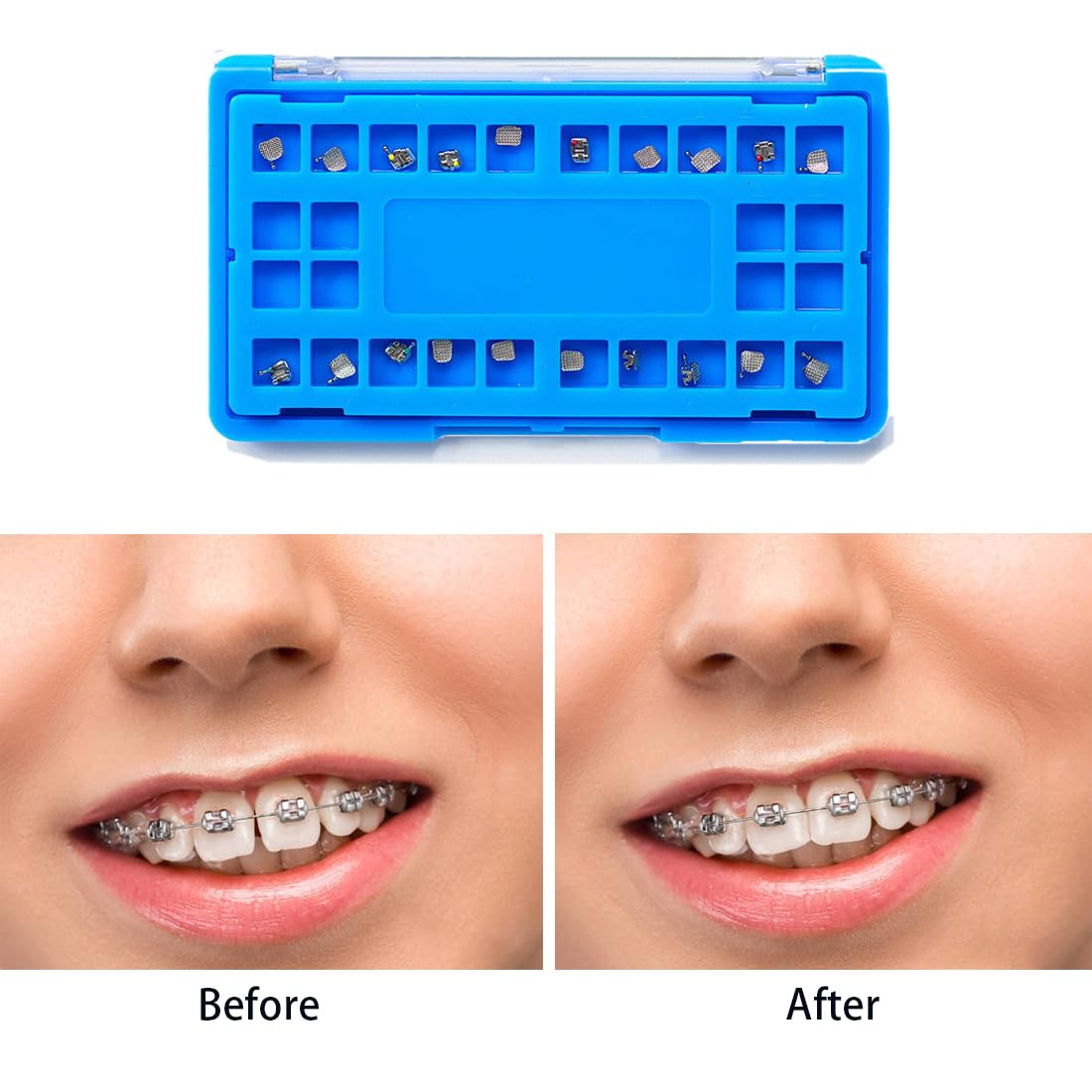 EASYTODENTA Soportes dentales de metal de ortodoncia mini soporte de dientes (ROTH 022 3.4.5 con ganchos)