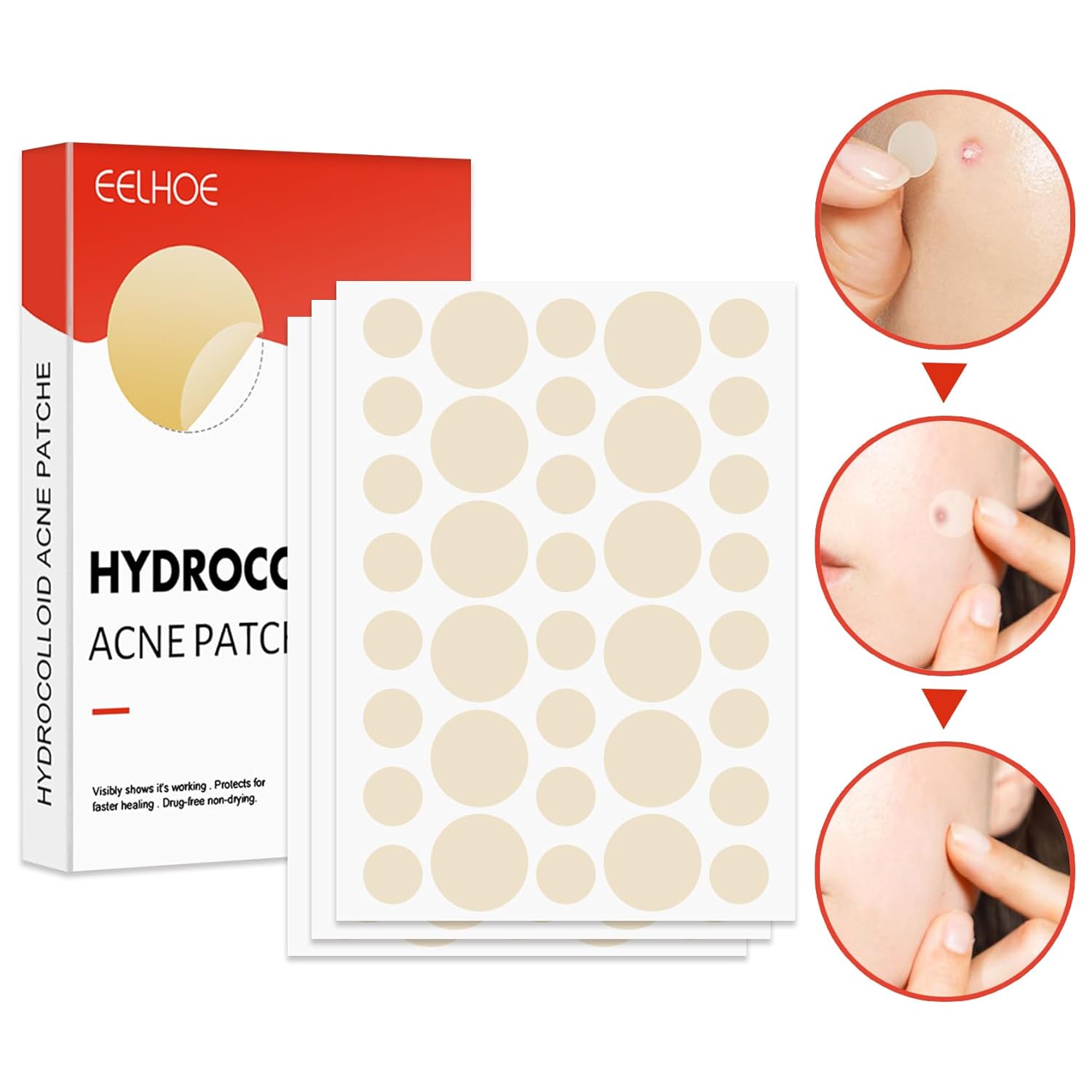 Parches hidrocoloides para cubrir el acné, parche de espinillas para acné, parches hidrocoloides para absorber el acné, calcomanías curativas para