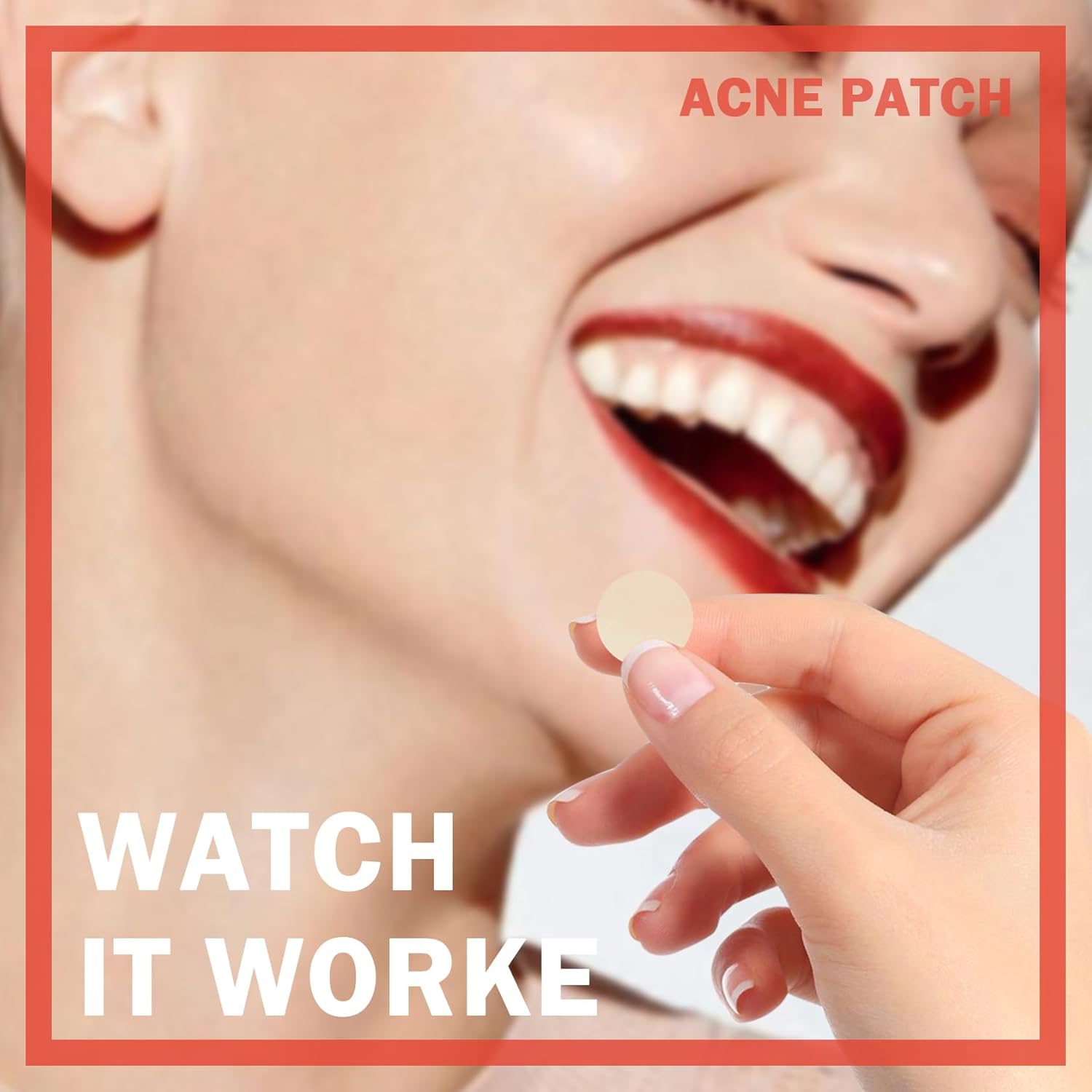 Parches hidrocoloides para cubrir el acné, parche de espinillas para acné, parches hidrocoloides para absorber el acné, calcomanías curativas para