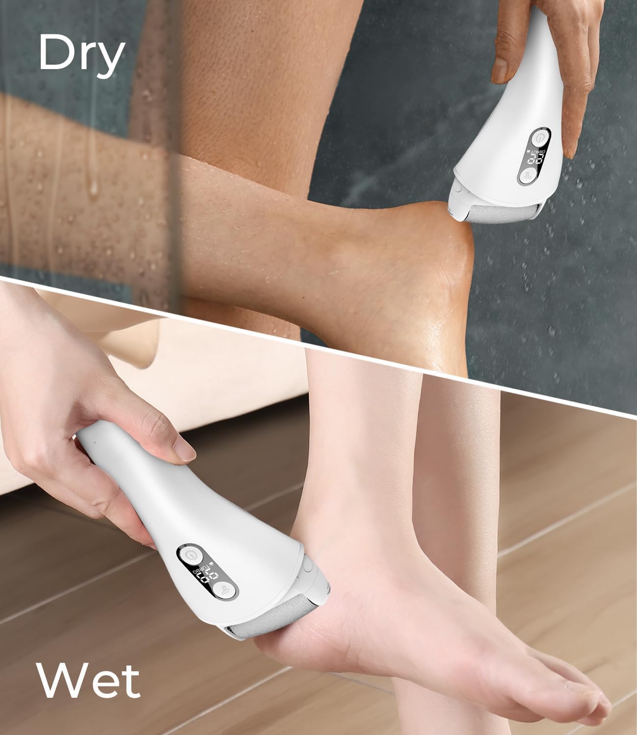 PRITECH – Removedor eléctrico de callos para pies, kit de herramientas de pedicura electrónica recargable para eliminación de callos, limpiador