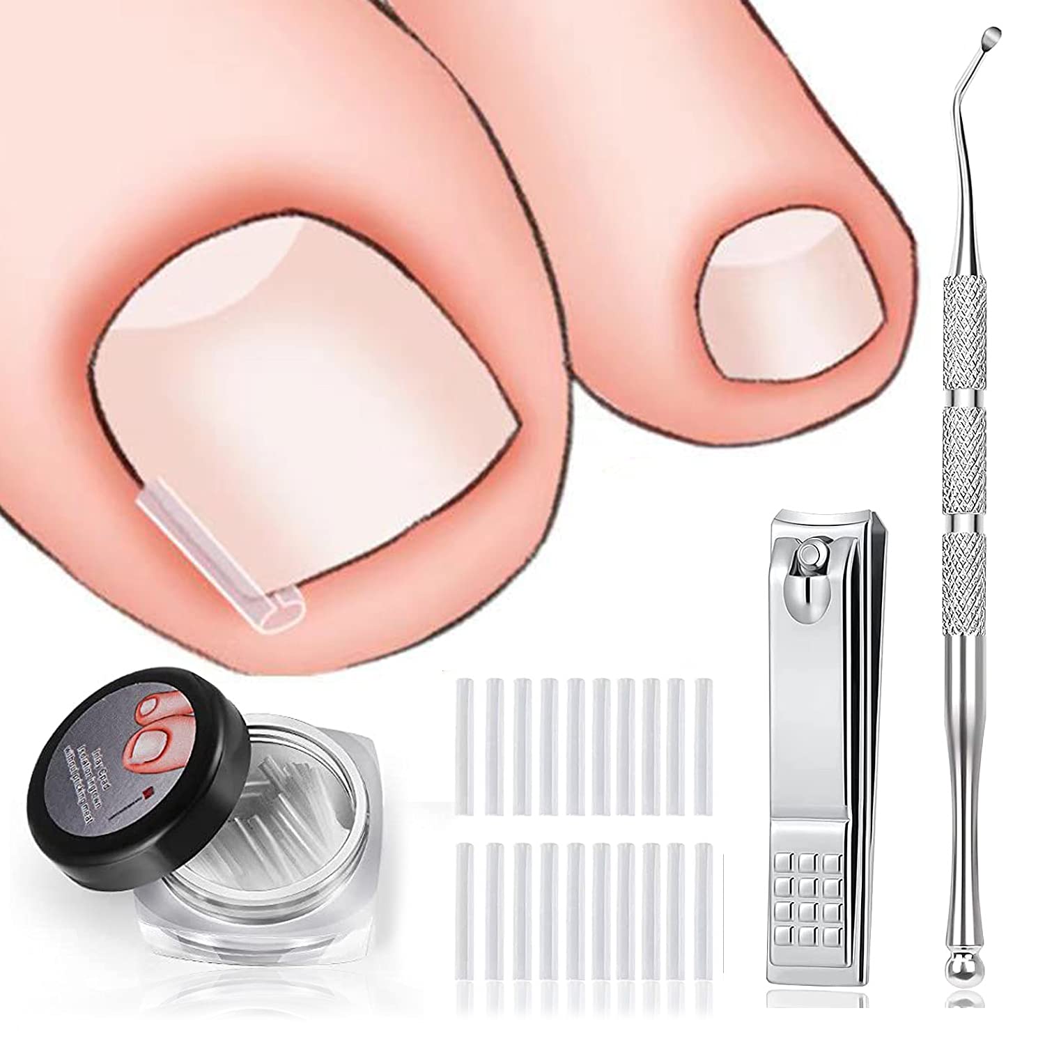 El tratamiento de uñas encarnadas incluye 60 tiras correctoras de uñas encarnadas, levantador de uñas encarnadas y cortaúñas, herramienta