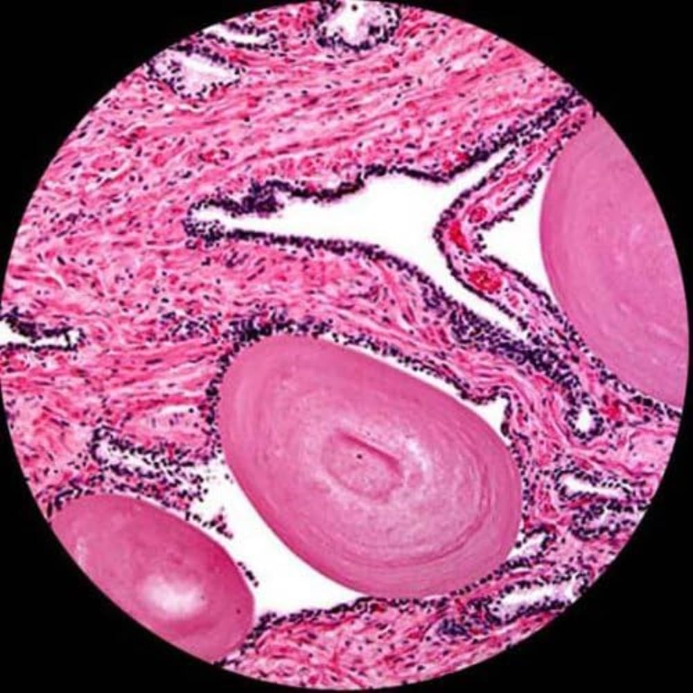 AmScope Microscopio compuesto trinocular digital T360B-10M, aumento 40X-2000X, oculares WF10x y WF20x, Brightfield, iluminación LED, condensador